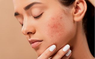 Kiedy udać się do dermatologa? Trądzik, alergia i inne przyczyny